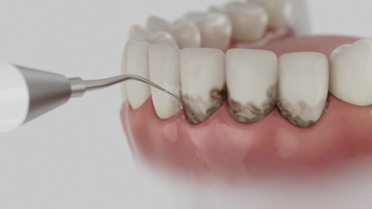 Trusted Wisdom Tooth Removal service in DeForest, WI - Dentist Open Now